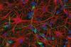 Murine neurons